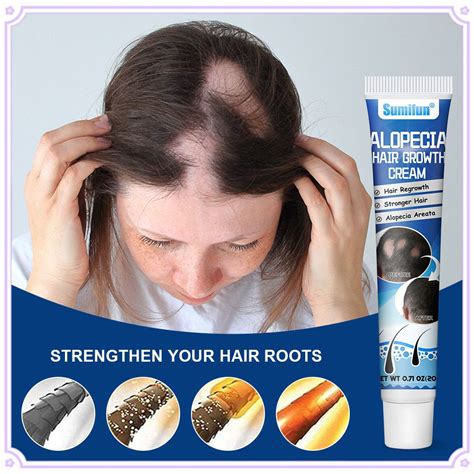 Sumifun Flavescens Alopecia Areata Cream Promote Hair Growth Prevent Hair Loss Smoothing