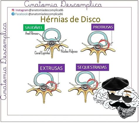 Anatomia Descomplica Peanuts Comics Comics Art