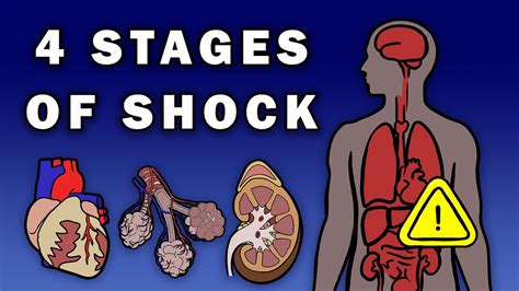 The 4 Stages Of Shock Youtube