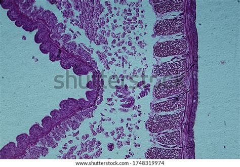 Earthworm Cs Under Microscope Closeup Stock Photo 1748319974 | Shutterstock