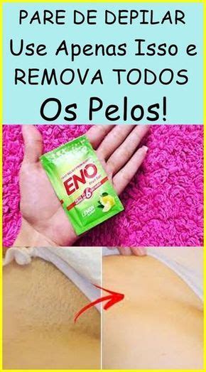 Receita Caseira Para Eliminar Verrugas No Corpo Todo Tips Belleza