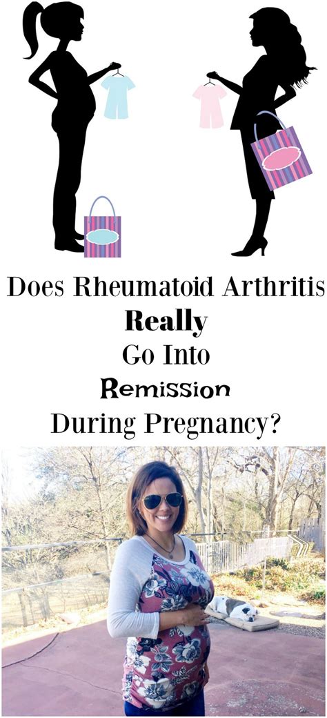 Does Rheumatoid Arthritis Really Go Into Remission During Pregnancy