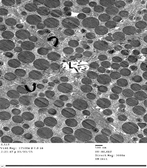 An Electron Micrograph Of An Ultrathin Section From The Exocrine Part