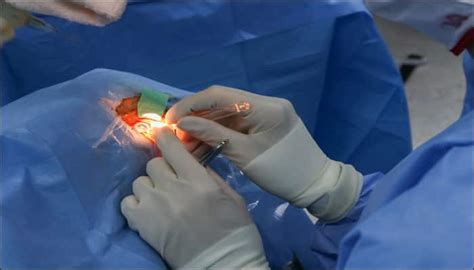 World's first robotic eye surgery performed in Britain! | Health News