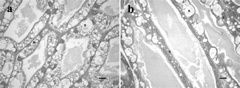 A Hepatopancreas Tissue Of Control Shrimp Exposed To 5 Psu After 25 Download Scientific