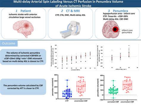 Multidelay Arterial Spin Labeling Versus Computed Tomography Perfusion