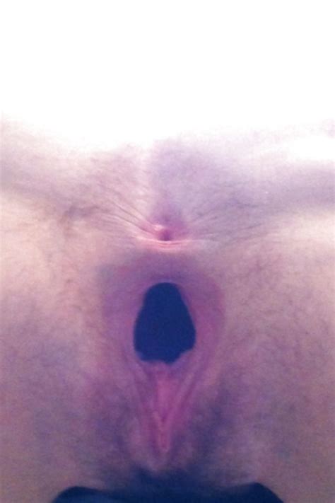 BLOWN OUT ASSHOLE Porn Pictures XXX Photos Sex Images 1980542 PICTOA