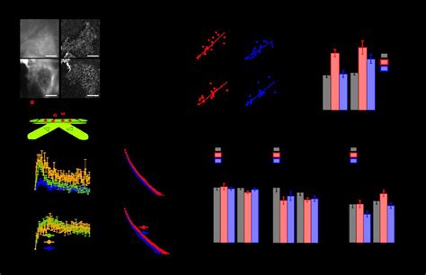 Membrane Translocation Of GRB2 And SHC A Epi Fluorescence Epi And