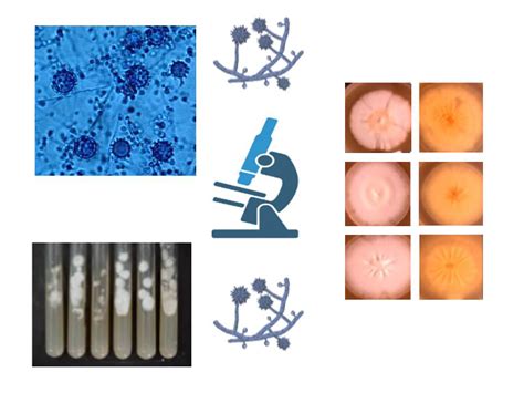 Fatores que interferem na produção de antígenos de Histoplasma