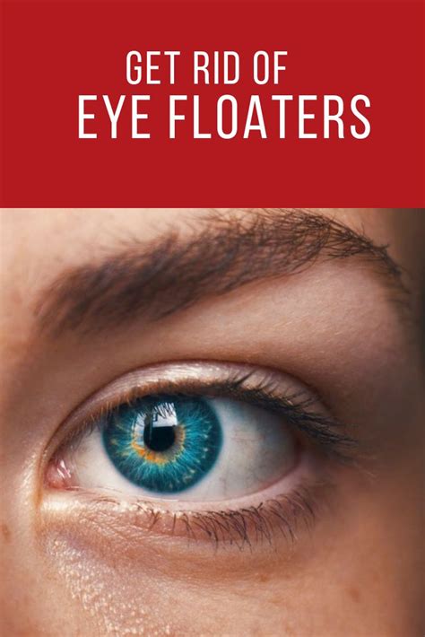 methods to get rid of eye floaters | Eyes, Eye health, How to stay healthy