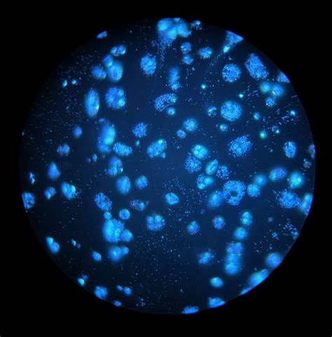 insect cells infected with Wolbachia - Entomology Today