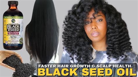 Black Seed Oil Hair Growth Before And After Discount Supplier, Save 44% ...