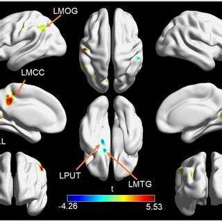 Brain Regions With Significant Changes In Cerebral Blood Flow CBF