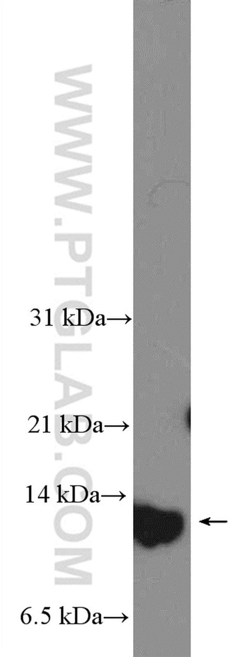 S100a7psoriasin Polyclonal Antibody 13061 1 Ap