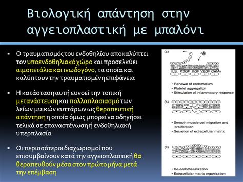 Θεματική ενότητα Stenting Γ Κούβελος Md Msc Phd Clinical And