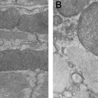 Electron Microscopy Observations Of Mitochondria In The Naked Mole Rat