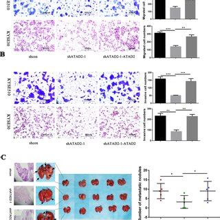 Atad Promotes Escc Cell Migration Invasion In Vitro And Metastasis In