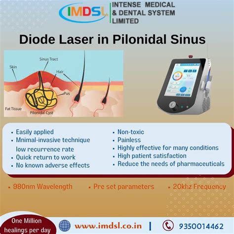 Treating Pilonidal Sinus With Surgical Laser