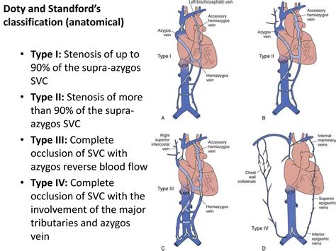 Superior Vena Cava Syndrome Ppt