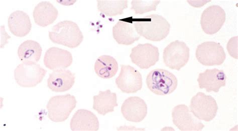 Parasites | Microbiology Spectrum