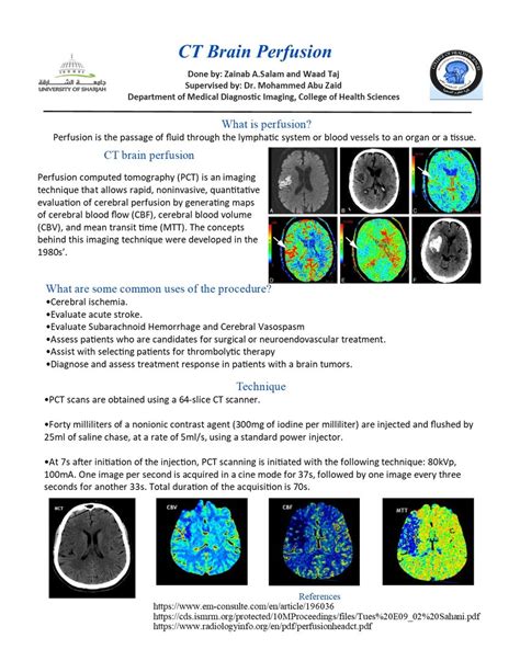 (PDF) CT brain perfusion