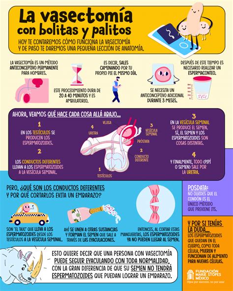 Precio De La Vasectom A En Cdmx Marie Stopes M Xico