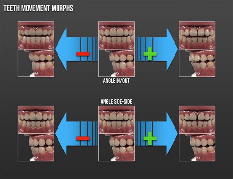 Ng Build Your Own Smile For Genesis 9 Dental Work Daz 3d