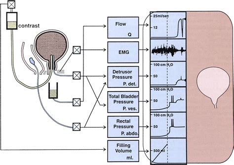 Urodynamic Evaluation Of The Bladder And Pelvic Floor