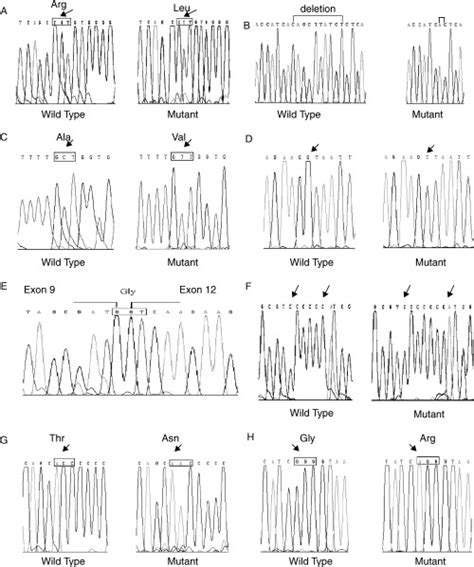 Seven Novel Mutations In The Factor Xiii A‐subunit Gene Causing Hereditary Factor Xiii