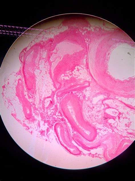 Blood vessel histology microscope