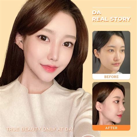 ボード「all You Need To Know About Korean Plastic Surgery」のピン