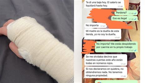 Despiden A Una Camarera En Benidorm Tras Lesionarse En El Trabajo