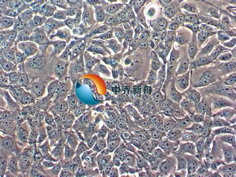 Kyse 140 细胞 细胞株 人食管鳞癌细胞 中乔新舟生物科技有限公司