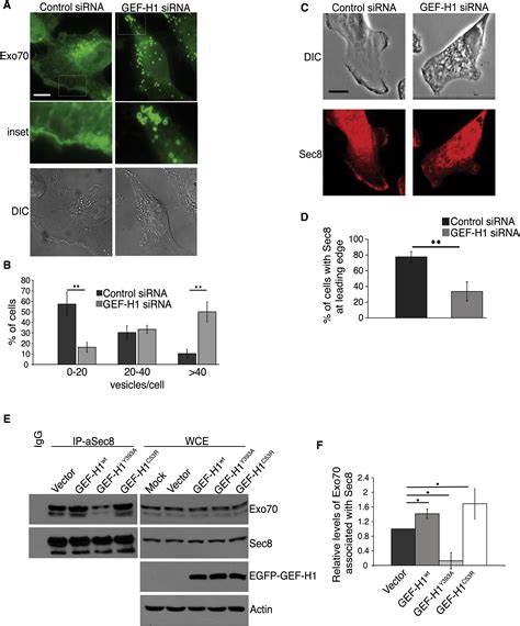 The Microtubule Associated Rho Activating Factor GEF H1 Interacts With