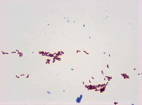 Mycobacterium Tuberculosis Laboatlas Off