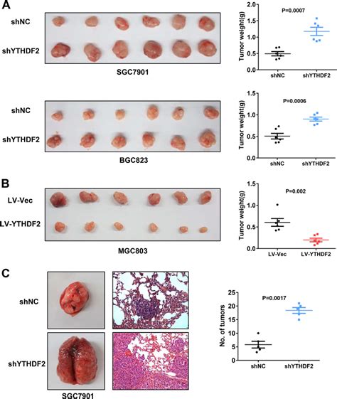 Ythdf2 Overexpression Attenuated Tumorigenicity And Metastasis Of