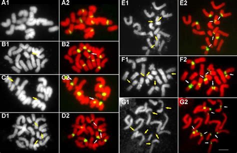 Fluorescence In Situ Hybridization With S Rdna As The Probe Shows