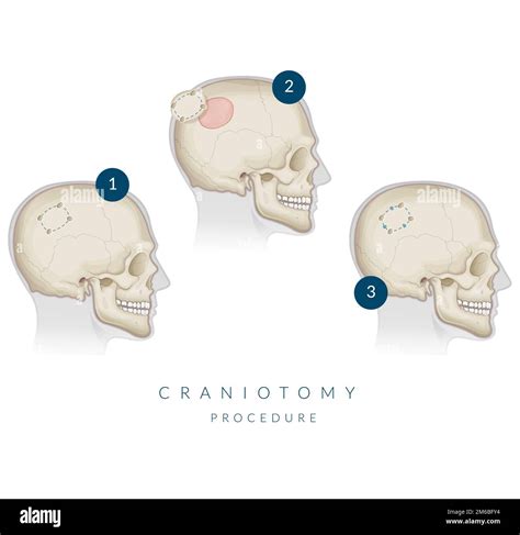 Le Dossier Anatomique Anatomie Banque D Images Vectorielles Alamy