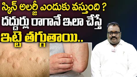 Dr Pawan Kumar స్కిన్ అలర్జీ ఎందుకు వస్తుంది Skin Allergy