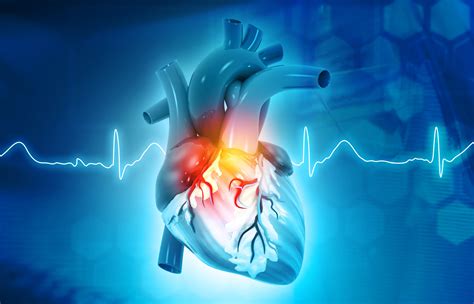 Complex congenital heart defects M3C Maladies rares de l hôpital