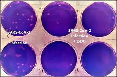 What Is 2DG Medicine All You Need To Know About DRDO S 2 Deoxy D