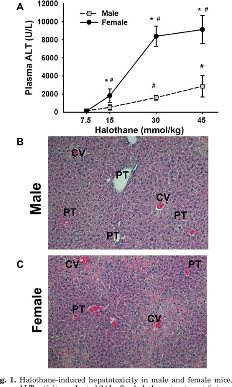 Figure 1 From A Mouse Model Of Severe Halothane Hepatitis Based On