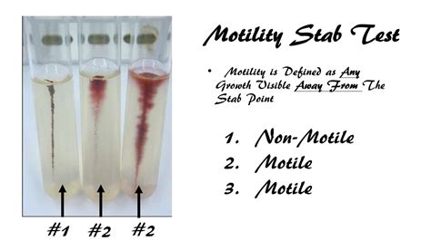 Ex 11 Motility Test Scientist Cindy