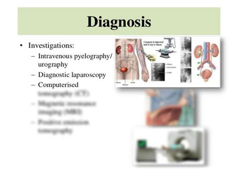 Solution Congenital Malformation Of Reproductive System Notes Studypool