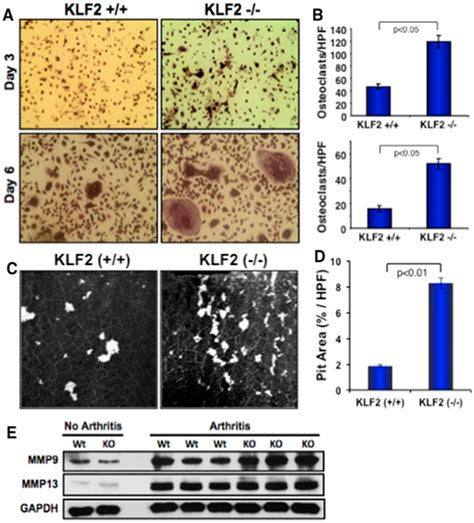 Cells Free Full Text Myeloid Krüppel Like Factor 2 Critically