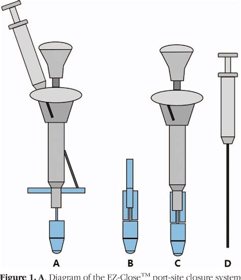 Figure From Evaluation Of A Novel Trocar Site Closure Device In