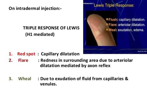 Antihistaminics Divya