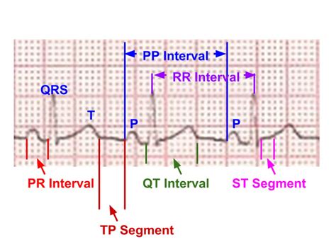 Segments And Intervals In An ECG