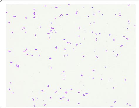 Coccus Microscope