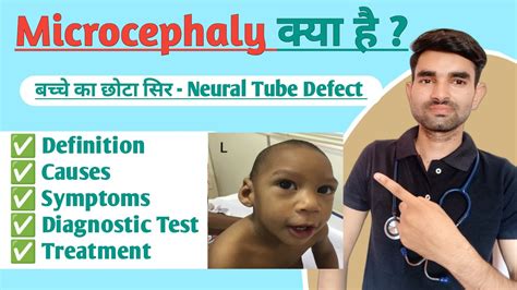 Microcephaly in Hindi | Causes, Symptoms And Treatment of Microcephaly - YouTube